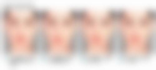 线雕隆鼻为什么会顶线？医生操作、材料选择及自身组织反应等因素或是关键所在！ 