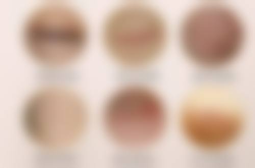 线提升隆鼻为什么会因术后护理不当顶线？