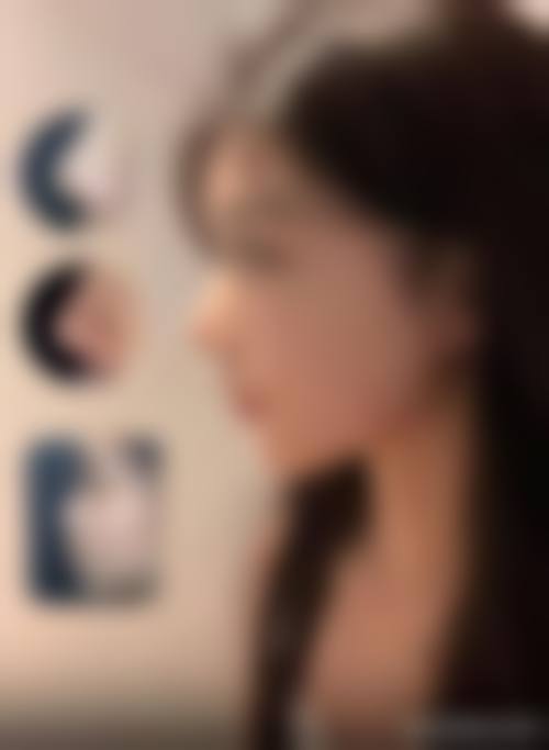 四、天津华雍整形医院特色项目