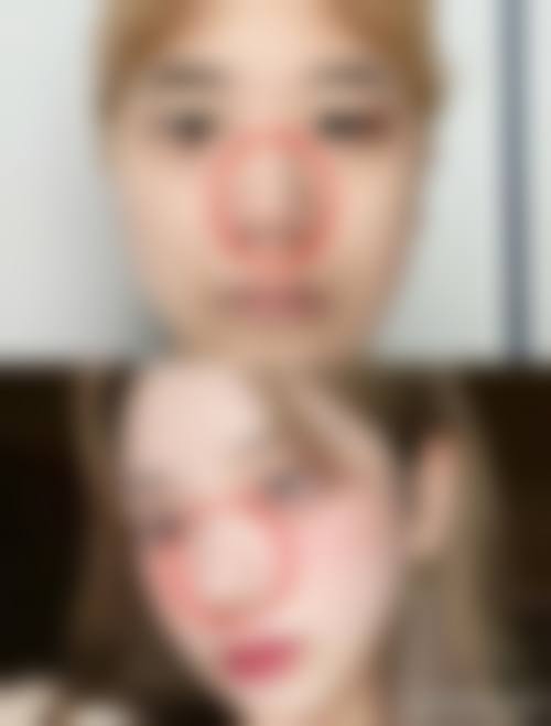 五、天津华雍整形医院收费价格表