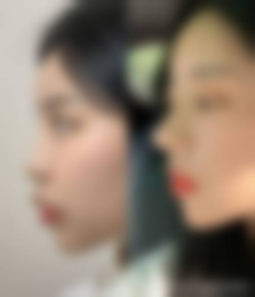 六、天津华雍整形医院口碑如何？