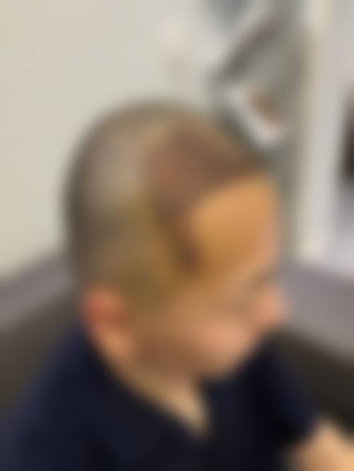 八、上海大麦微针植发怎么预约？