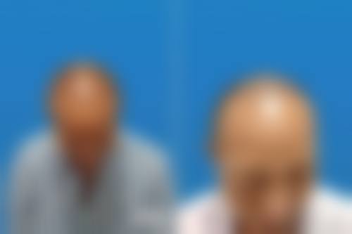 七、上海大麦微针植发地址电话及营业时间