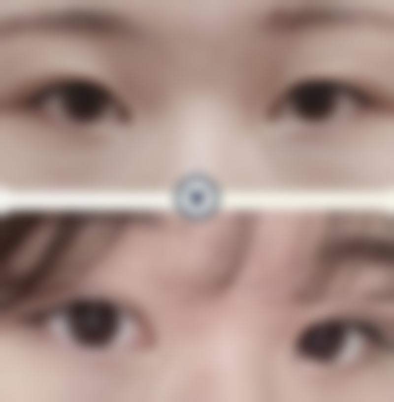 六、太原美娜净誉医疗美容诊所口碑如何？