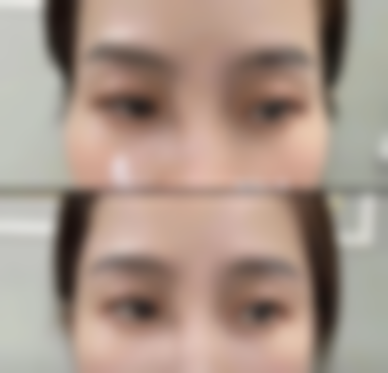 七、徐州京城皮肤病医院医疗美容曹赐斌医生怎么预约?