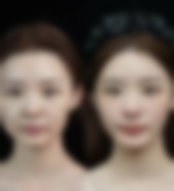 三、泰国清迈lannawadee兰纳瓦德整形TeerasakPhadayakul医生资质信息