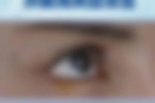 日常护理去除眼袋：长期坚持，预防为主