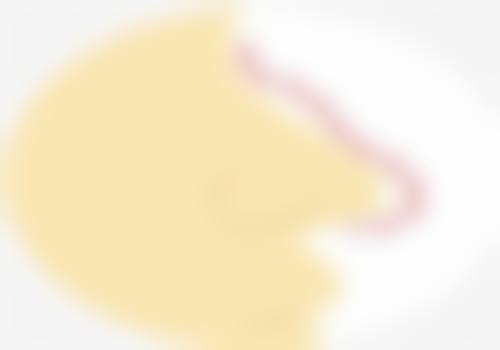 七、泰国清迈lannawadee兰纳瓦德整形ThawipornTriprapakorn医生怎么预约?