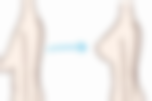 三、泰国清迈lannawadee兰纳瓦德整形ThawipornTriprapakorn医生资质信息