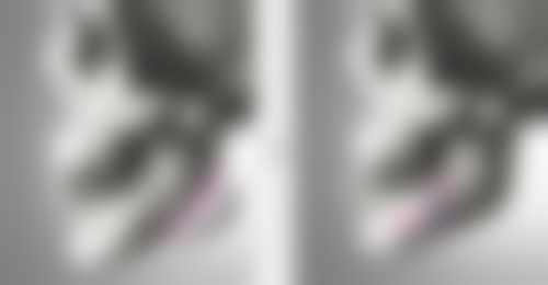 非手术去除眼袋：温和有效，适合多数人