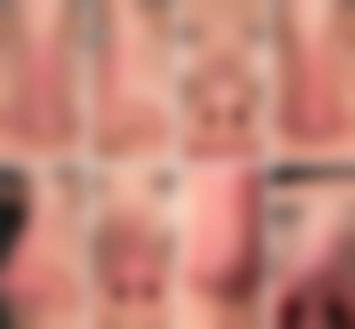 八、徐州矿务总医院整形美容中 心怎么预约?