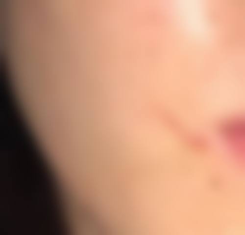 六、香河韩博仕医疗美容门诊部口碑如何？