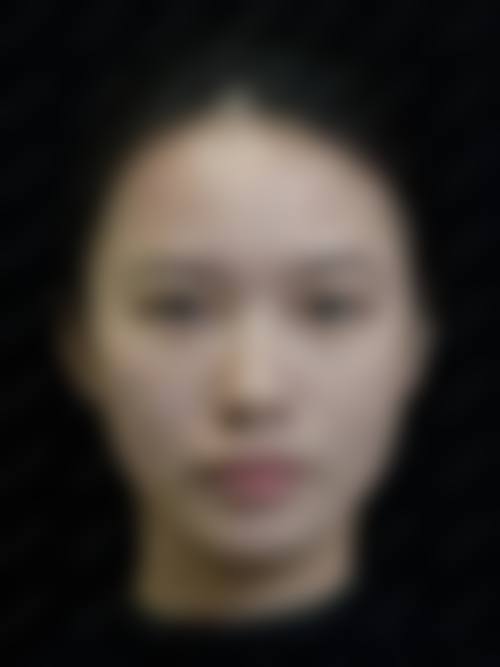 八、咸宁市中 心医院医学美容中 心怎么预约?