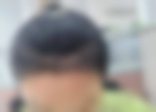 七、深圳雍禾植发医院地址电话及营业时间