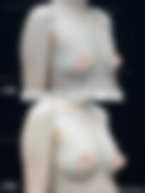 六、葫芦岛伊丽家整形医院口碑如何？