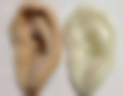 五、咸宁市中 心医院医学美容中 心收费价格表