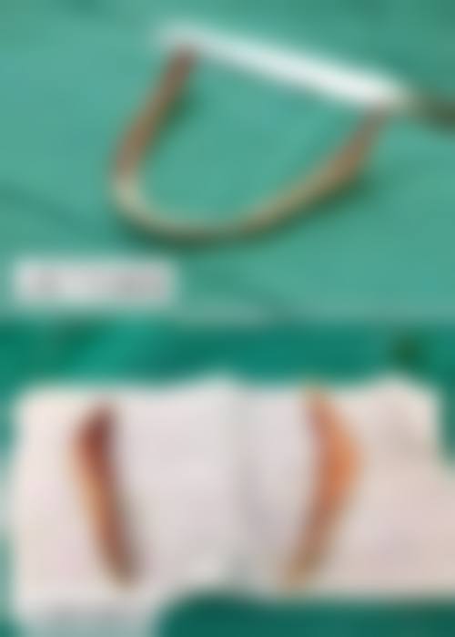 六、宣城华艺医学整形美容美容门诊部口碑如何？