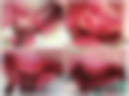 四、湖南省第二人民医院医学美容科特色项目