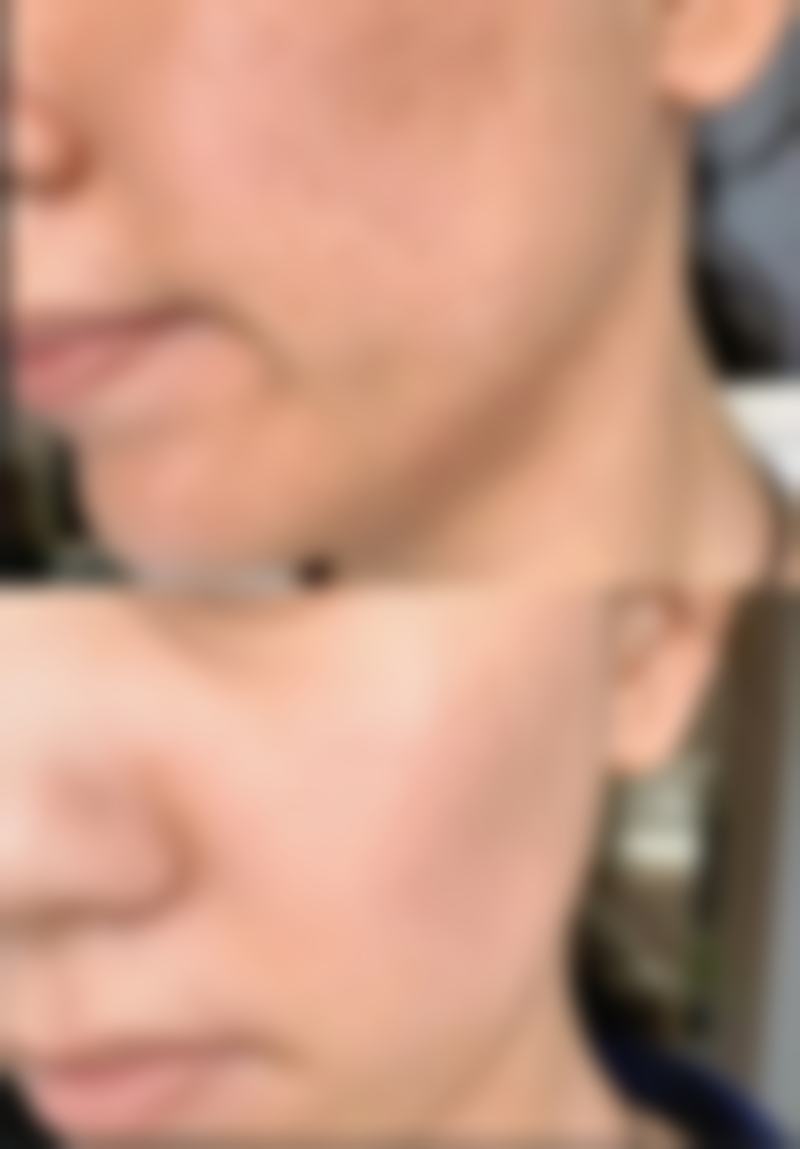 二、济南雅尚医疗美容田乾医生擅长项目