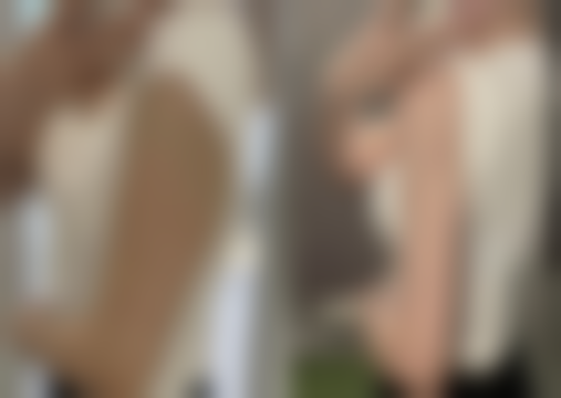 五、徐州京城皮肤病医疗美容陈铁琳医生技术怎么样?