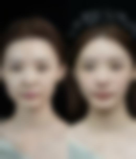 六、涪城医而美宋曰强医生口碑评价及真人实例反馈