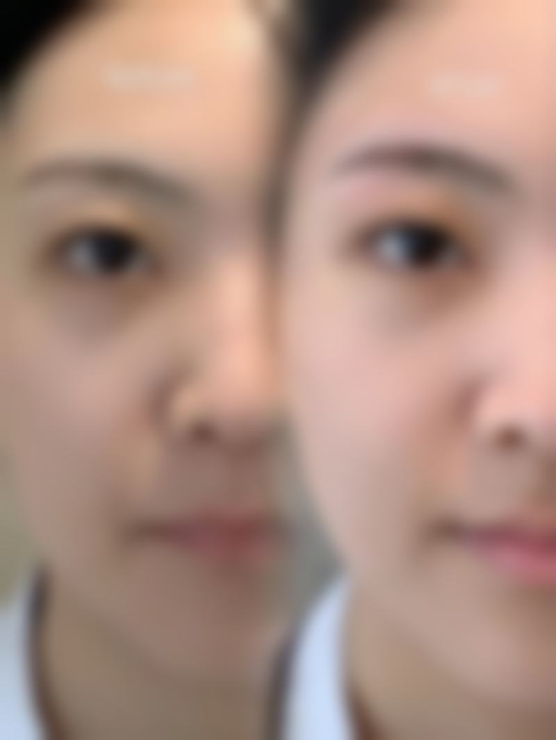 五、成都刘影美容整形门诊部收费价格表