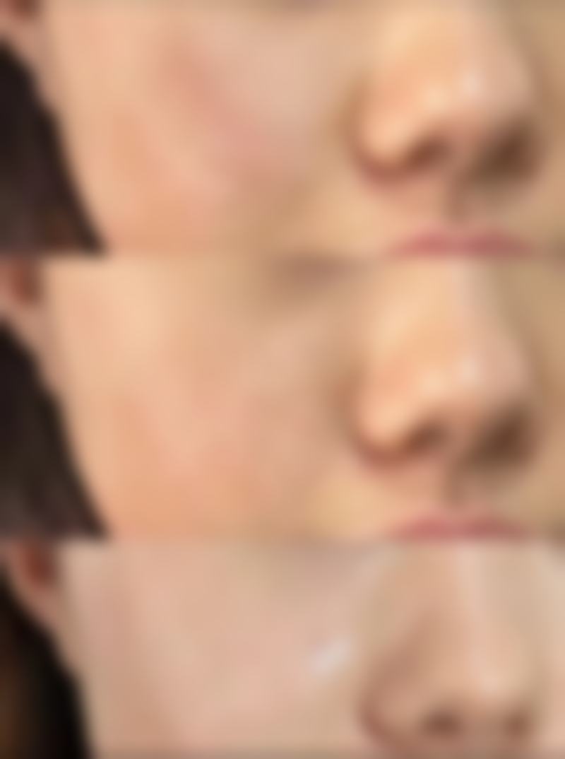 药物治疗：从内部入手改善疤痕