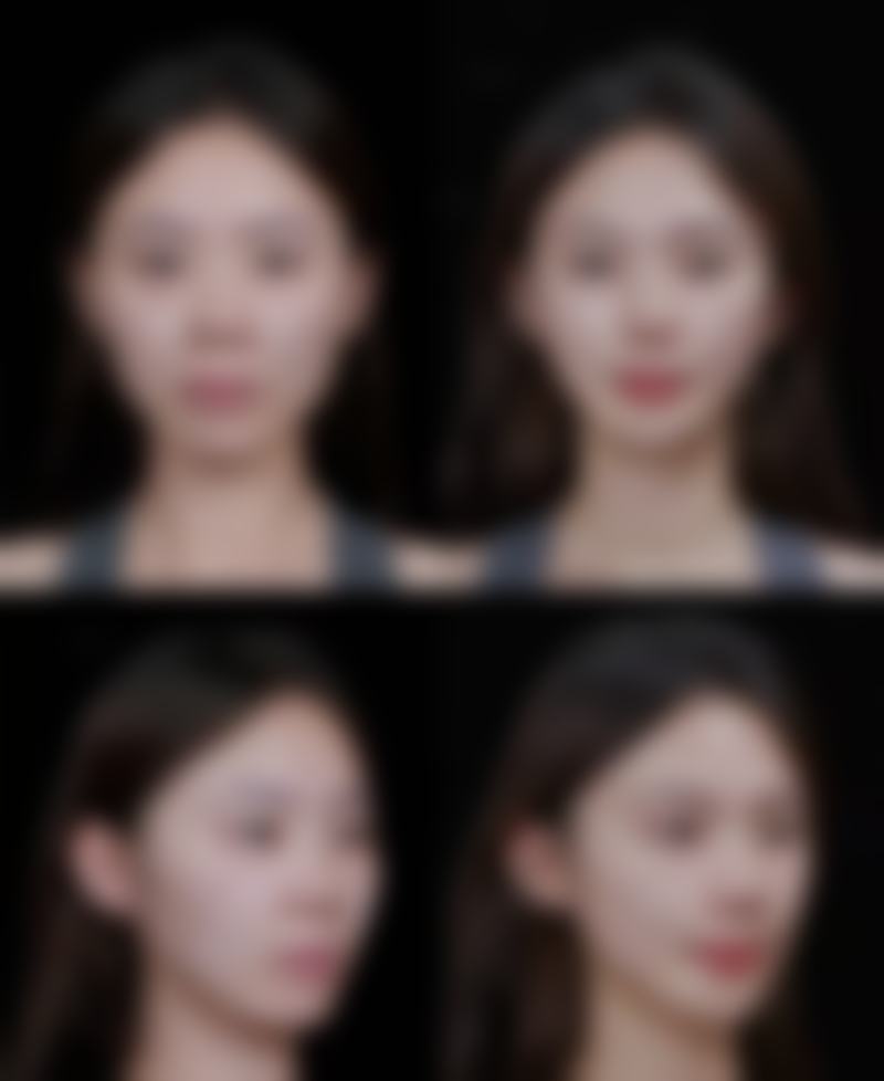 七、济南雅尚医疗美容李纯明医生怎么预约？