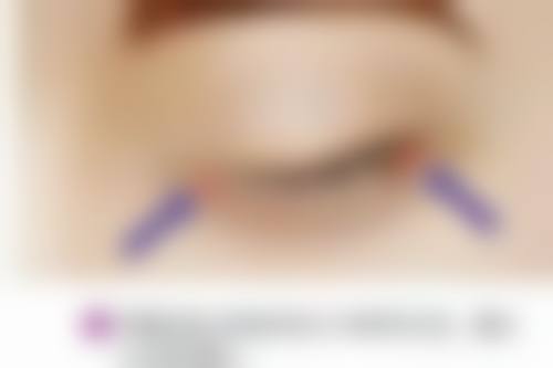 六、徐州京城皮肤病医疗美容曹赐斌医生口碑评价及真人实例反馈