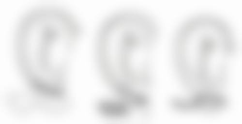 割双眼皮14天了还是肿怎么办？或是正常现象、感染等原因，缓解方法都在这！ 