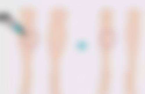 男的隆胸需要正视的伦理争议