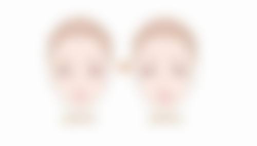 有疤痕增生怎么消除好？可通过涂抹药膏、激光等方法改善，严重时手术治疗更有效！ 