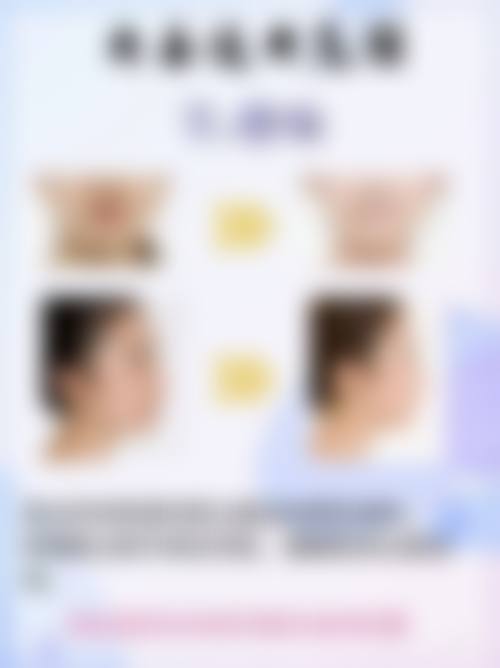 多磺酸粘多糖乳膏