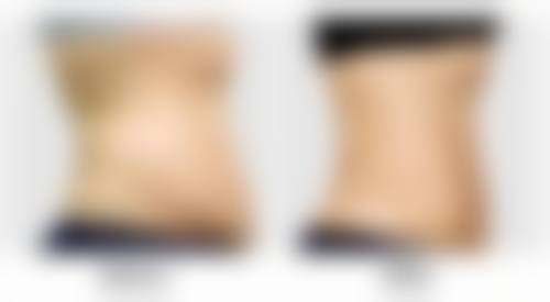 七、徐州京城皮肤病医疗美容曹赐斌医生怎么预约?