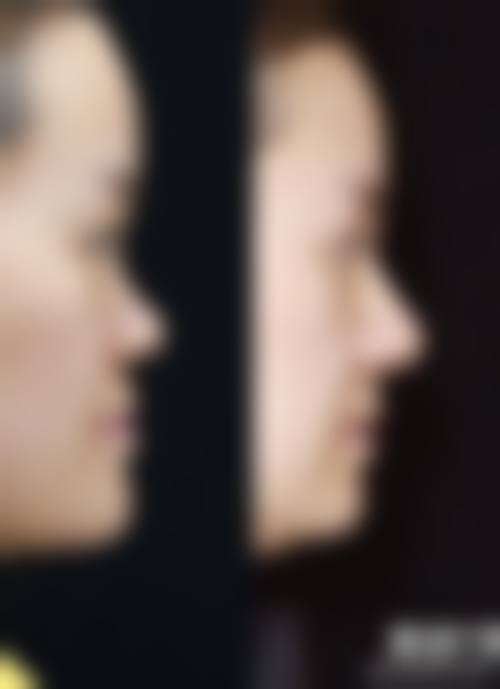 五、杭州美知艺尚医疗美容诊所收费价格表