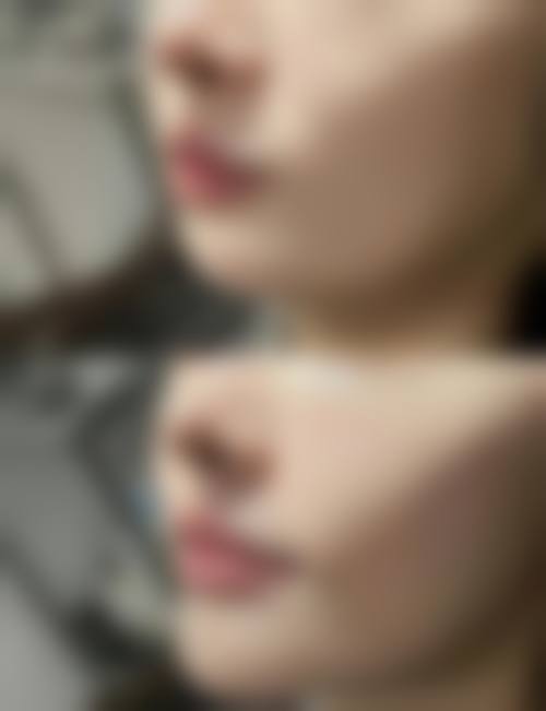 八、Rize Clinic 心斎桥怎么预约?