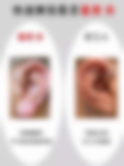 六、上海科妍希尔整形医院口碑如何？