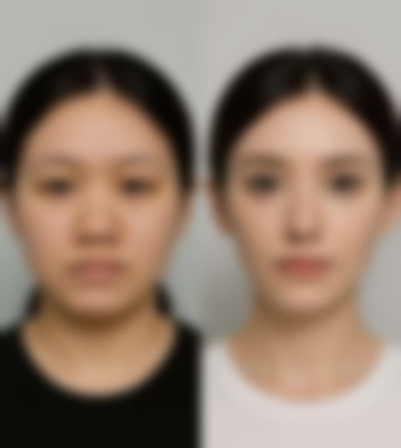 六、南京恰美医疗美容口碑如何？