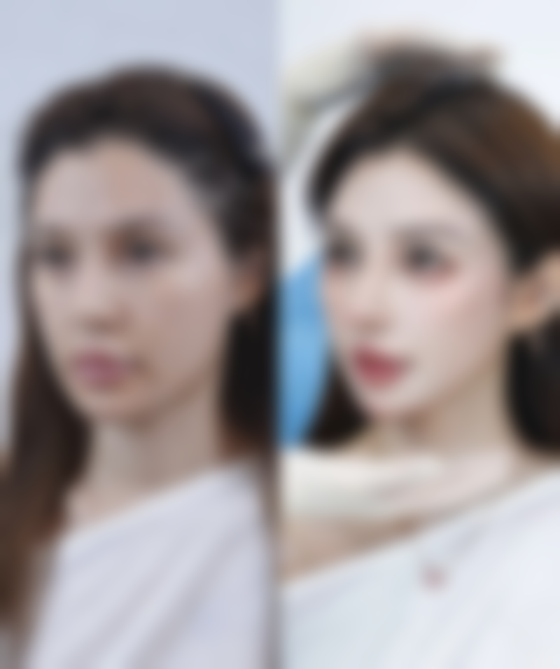 六、上海大麦微针植发黄志春医生口碑评价及真人实例反馈