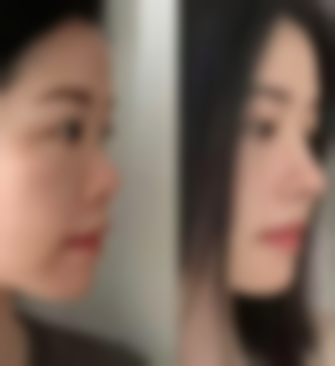 使用祛疤膏的其他注意事项