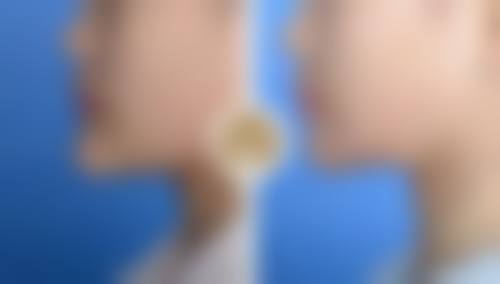 七、广州美携医疗美容林肖医生怎么预约?