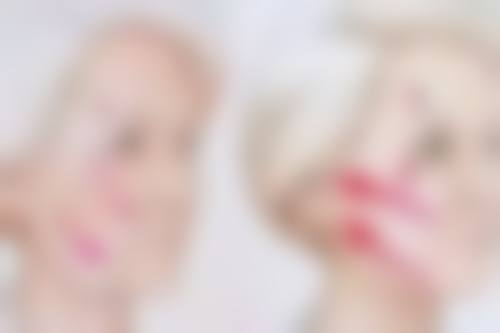 埋线双眼皮有什么危害不？术式本身存在潜在问题