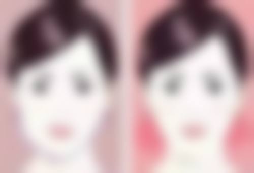 四、上海大麦微针植发栾星微医生坐诊医院