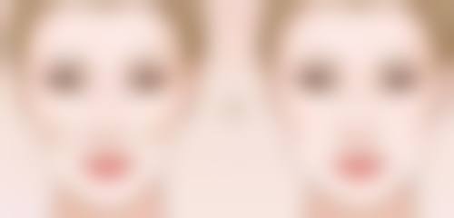 二、株洲华美整形美容黄明光医生擅长项目