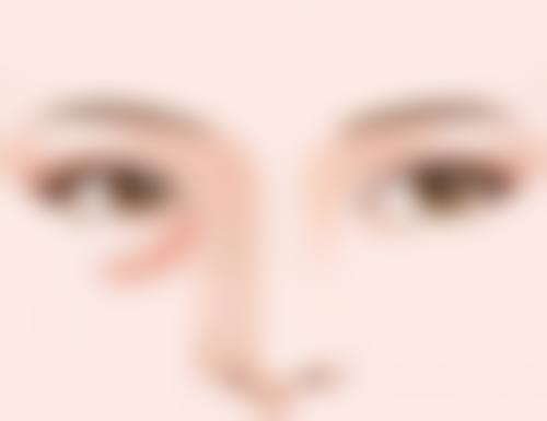 面部除皱用什么针之自体脂肪针