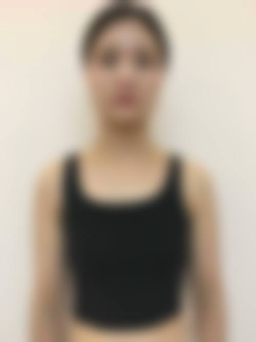 五、昆明悦美人整形医院收费价格表