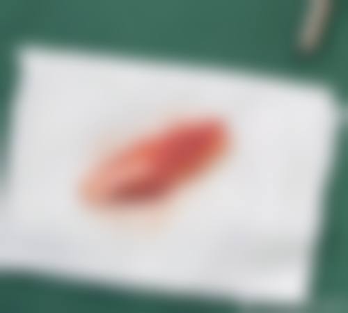 四、皖南医学校第二附属医院(烧伤整形科)特色项目