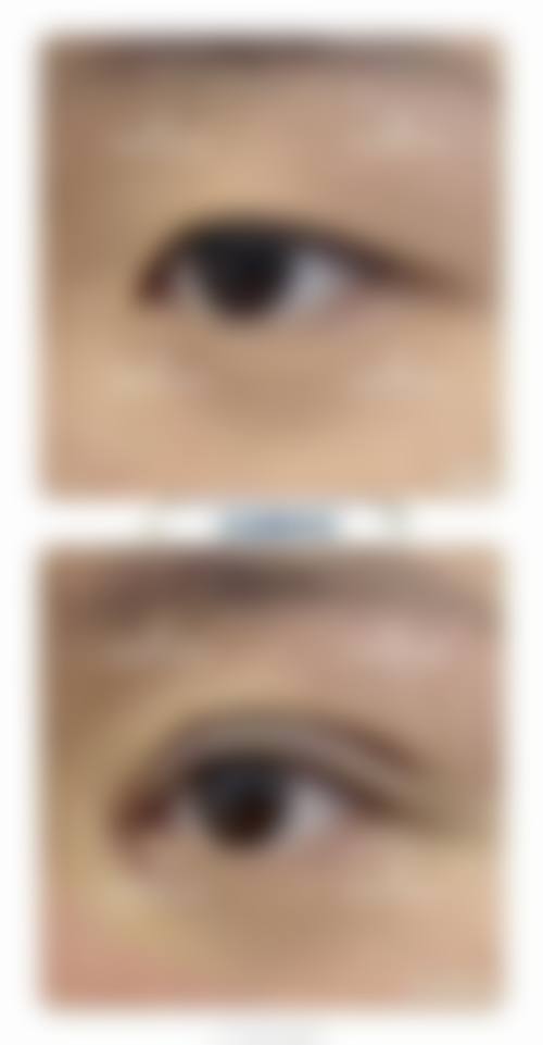 六、清远立峰整形医院口碑如何？