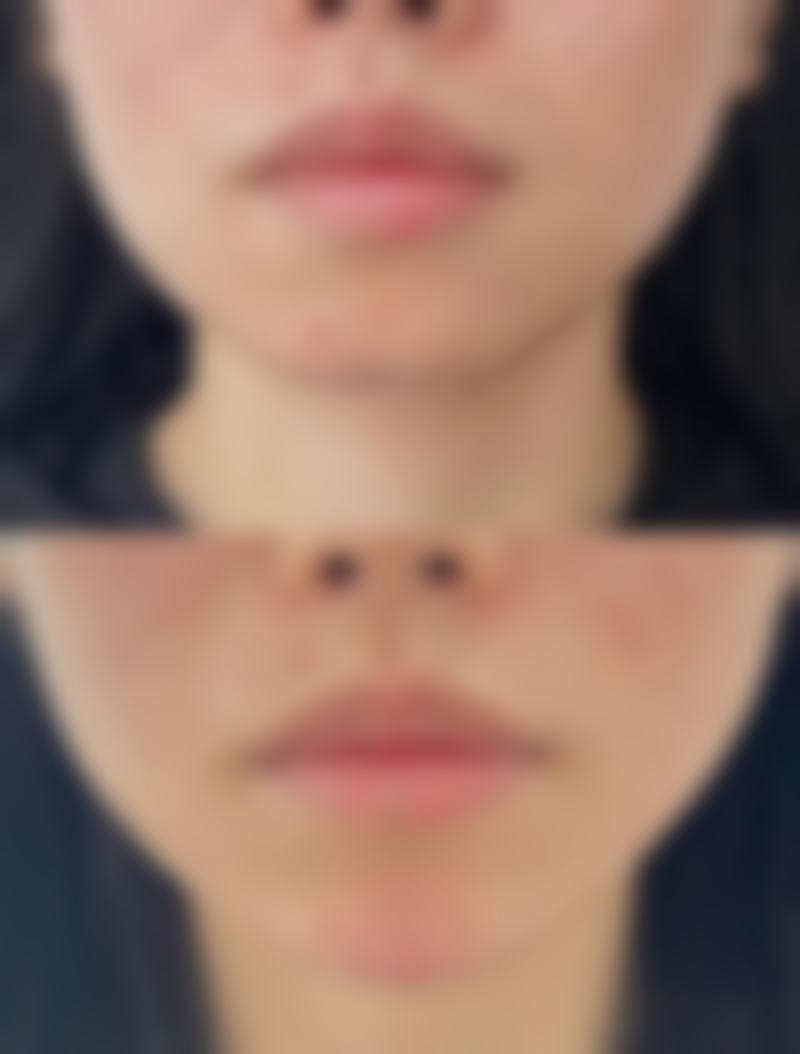 八、amond整形外科怎么预约？