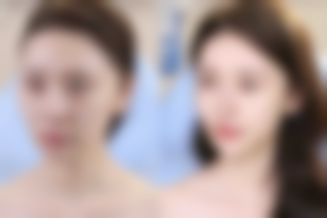 五、北京岩之畔整形美容医院收费价格表